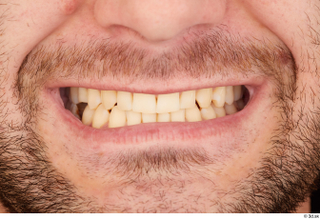 Anatoly teeth 0001.jpg